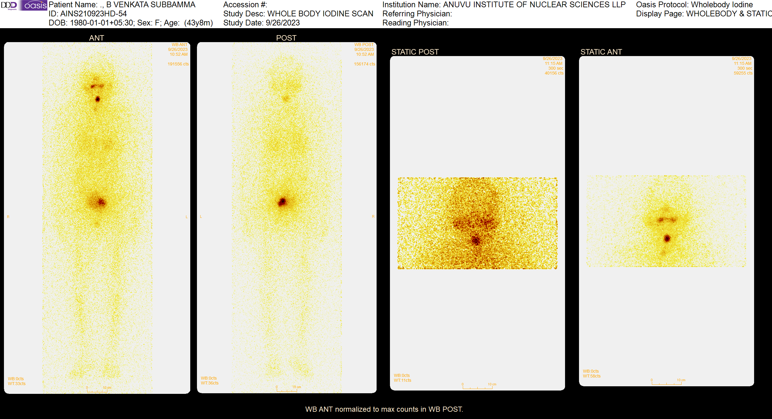 I131 High Dose Therapy Scan